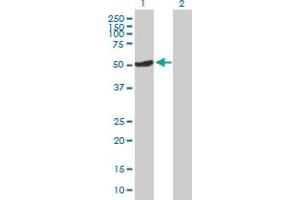Western Blot analysis of OSGIN1 expression in transfected 293T cell line by OSGIN1 MaxPab polyclonal antibody. (OSGIN1 抗体  (AA 1-477))