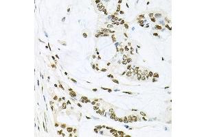 Immunohistochemistry (Paraffin-embedded Sections) (IHC (p)) image for anti-Mitogen-Activated Protein Kinase 8 (MAPK8) (AA 245-345) antibody (ABIN3020887)