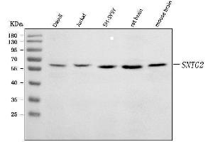 Western blot analysis of SNTG2 using anti-SNTG2 antibody (ABIN7599617).