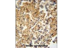 ZMYND10 Antibody (C-term) (ABIN652018 and ABIN2840499) immunohistochemistry analysis in formalin fixed and paraffin embedded human testis carcinoma followed by peroxidase conjugation of the secondary antibody and DAB staining. (ZMYND10 抗体  (C-Term))