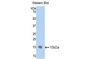 Western Blotting (WB) image for anti-Polymeric Immunoglobulin Receptor (PIGR) (AA 135-237) antibody (ABIN1174189) (PIGR 抗体  (AA 135-237))