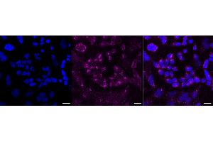 Immunocytochemical staining of HeLa cells with Alkaline phosphatase antibody (ABIN7797575), 1:1,000). (Recombinant Alkaline Phosphatase 抗体)