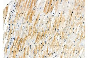 ABIN6258665 and ABIN6273727 at 1/100 staining Rat heart tissue by IHC-P.