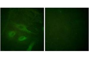 Immunofluorescence analysis of HeLa cells, using IkappaB-epsilon (Ab-22) Antibody. (IkappaB-epsilon 抗体  (AA 131-180))
