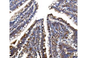 IHC analysis of MLX-interacting protein/MLXIP using anti-MLX-interacting protein/MLXIP antibody (ABIN7602593).