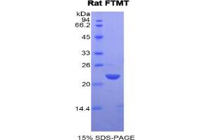 SDS-PAGE analysis of Rat FTMT Protein. (Ferritin Mitochondrial 蛋白)