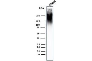 Western Blot Analysis of human brain tissue lysate using Neurofilament MAb (SPM563). (NEFH 抗体)