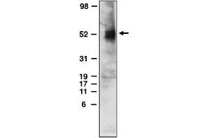 Western Blotting (WB) image for anti-Sphingosine-1-Phosphate Receptor 4 (S1PR4) (C-Term) antibody (ABIN264453) (S1PR4 抗体  (C-Term))