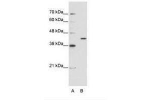 Image no. 1 for anti-Exoribonuclease 1 (ERI1) (AA 231-280) antibody (ABIN202308) (ERI1 抗体  (AA 231-280))