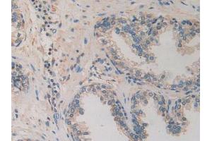 IHC-P analysis of Human Prostate Gland Tissue, with DAB staining. (CACYBP 抗体  (AA 2-228))