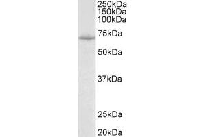 Western Blotting (WB) image for anti-Solute Carrier Family 6 (Neurotransmitter Transporter, Creatine), Member 8 (SLC6A8) (Internal Region) antibody (ABIN940551)