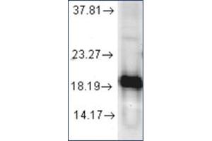 Image no. 1 for anti-Superoxide Dismutase 1, Soluble (SOD1) antibody (ABIN264854) (SOD1 抗体)