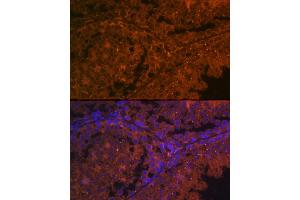 Immunofluorescence (IF) image for anti-Angiotensin I Converting Enzyme 2 (ACE2) (AA 18-250) antibody (ABIN6136429)