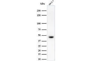 Western Blot Analysis of MCF-7 cell lysate using Cytokeratin, HMW Mouse Monoclonal Antibody (34BE12). (Cytokeratin 2 抗体)