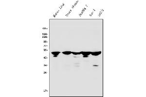 Western blot analysis of IRF3 using anti-IRF3 antibody (ABIN7599373).