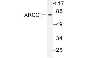 Image no. 1 for anti-X-Ray Repair Complementing Defective Repair in Chinese Hamster Cells 1 (XRCC1) antibody (ABIN271979) (XRCC1 抗体)