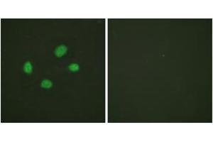 Immunofluorescence analysis of HeLa cells, using Chk2 (Phospho-Thr383) Antibody. (CHEK2 抗体  (pThr383))