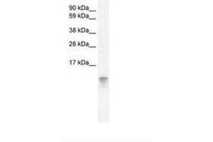 Image no. 2 for anti-Fatty Acid Binding Protein 3, Muscle and Heart (FABP3) (AA 46-95) antibody (ABIN202026) (FABP3 抗体  (AA 46-95))