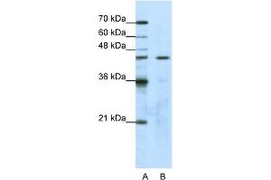 WB Suggested Anti-GTPBP9 Antibody Titration:  1. (OLA1 抗体  (N-Term))