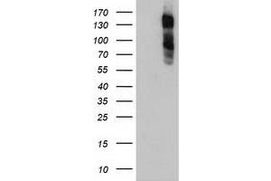 HEK293T cells were transfected with the pCMV6-ENTRY control (Left lane) or pCMV6-ENTRY ENPEP (Right lane) cDNA for 48 hrs and lysed. (ENPEP 抗体)