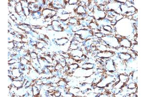 Immunohistochemistry (IHC) image for anti-Actin, alpha 2, Smooth Muscle, Aorta (ACTA2) (N-Term) antibody (ABIN6940521)