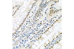 Immunohistochemistry (Paraffin-embedded Sections) (IHC (p)) image for anti-Mitogen-Activated Protein Kinase 8 (MAPK8) (AA 245-345) antibody (ABIN3020887)
