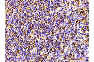 Immunohistochemistry (IHC) image for anti-Phosphoinositide 3 Kinase, p85 alpha (PI3K p85a) (pTyr607) antibody (ABIN6256775)