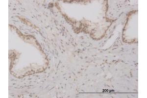 Immunoperoxidase of monoclonal antibody to FOXO3A on formalin-fixed paraffin-embedded human prostate. (FOXO3 抗体  (AA 361-460))