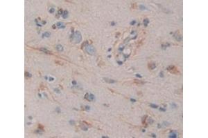 Used in DAB staining on fromalin fixed paraffin- embedded brain tissue (MPI 抗体  (AA 2-423))