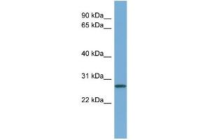 Western Blotting (WB) image for anti-Cyclin D-Type Binding-Protein 1 (CCNDBP1) (Middle Region) antibody (ABIN2786197)