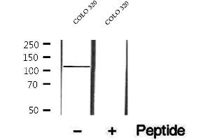 Western blot analysis of extracts of COLO 320 cells, using p107 antibody. (p107 抗体  (C-Term))