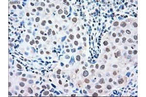 Image no. 5 for anti-Mitogen-Activated Protein Kinase 1 (MAPK1) antibody (ABIN1499291)