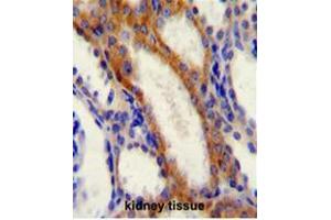 Immunohistochemistry (Paraffin-embedded Sections) (IHC (p)) image for anti-Stromal Interaction Molecule 1 (STIM1) (AA 516-546), (C-Term) antibody (ABIN954978)