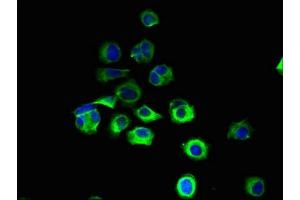Immunofluorescent analysis of MCF-7 cells using ABIN7151123 at dilution of 1:100 and Alexa Fluor 488-congugated AffiniPure Goat Anti-Rabbit IgG(H+L) (RNF13 抗体  (AA 432-685))