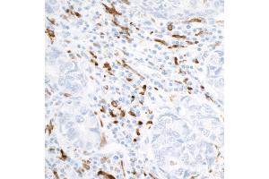 Immunohistochemistry (IHC) image for anti-CD163 (CD163) (AA 850-900) antibody (ABIN7448890) (Recombinant CD163 抗体  (AA 850-900))