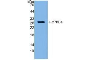 Detection of Recombinant LOXL1, Mouse using Polyclonal Antibody to Lysyl Oxidase Like Protein 1 (LOXL1) (LOXL1 抗体  (AA 392-598))