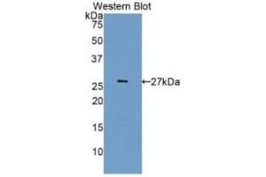 Detection of Recombinant CDK5, Human using Monoclonal Antibody to Cyclin Dependent Kinase 5 (CDK5) (CDK5 抗体  (AA 92-273))