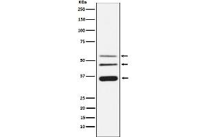 Western blot analysis of Legumain expression in HeLa cell lysate. (Recombinant LGMN 抗体)