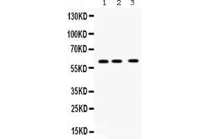 Western blot analysis of TCP1 theta expression in rat brain extract ( Lane 1), mouse brain extract ( Lane 2) and U20S whole cell lysates ( Lane 3).