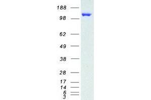 Validation with Western Blot