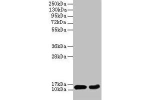 Western blot All lanes: EIF4EBP2 antibody at 2 μg/mL Lane 1: Mouse heart tissue Lane 2: NIH/3T3 whole cell lysate Secondary Goat polyclonal to rabbit IgG at 1/10000 dilution Predicted band size: 13 kDa Observed band size: 13 kDa (eIF4EBP2 抗体  (AA 1-120))