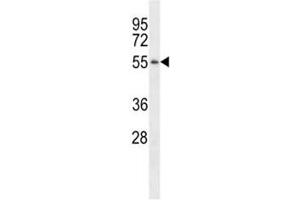 Western blot analysis of TSPY antibody pre-incubated without (Lane 1) and with (2) blocking peptide in LNCAP lysate. (TSPY1 抗体  (AA 274-303))