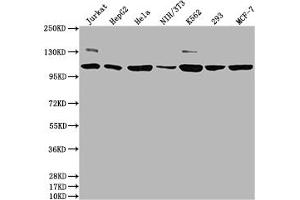 Western Blot Positive WB detected in: Jurkat whole cell lysate, HepG2 whole cell lysate, Hela whole cell lysate, NIH/3T3 whole cell lysate, K562 whole cell lysate, 293 whole cell lysate, MCF-7 whole cell lysate All lanes: PIK3CA antibody at 1:1500 Secondary Goat polyclonal to rabbit IgG at 1/50000 dilution Predicted band size: 125 kDa Observed band size: 110 kDa