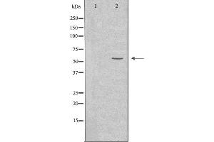 Western blot analysis of extracts from Jurkat cells, using Cytochrome P450 2A6 antibody. (CYP2A6 抗体  (N-Term))