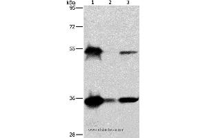 Western blot analysis of Hela, K562 and Raji cell, using BAG1 Polyclonal Antibody at dilution of 1:750 (BAG1 抗体)