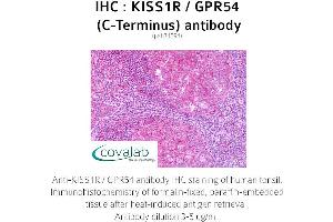 Image no. 1 for anti-KISS1 Receptor (KISS1R) (C-Term) antibody (ABIN1736238) (KISS1R 抗体  (C-Term))
