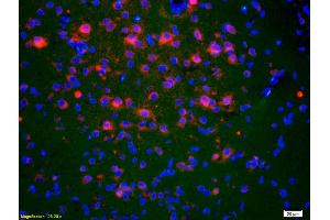 Formalin-fixed and paraffin-embedded rat brain labeled with Anti-ACTH (1-39) Polyclonal Antibody, Unconjugated (ABIN668676) 1:200, overnight at 4°C, The secondary antibody was Goat Anti-Rabbit IgG, Cy3 conjugated used at 1:200 dilution for 40 minutes at 37°C. (ACTH 抗体  (AA 1-39))