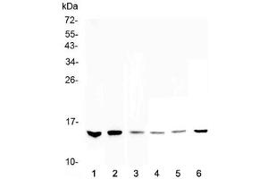 Western blot testing of 1) human HeLa, 2) human MDA-MB-231, 3) human MDA-MB-451, 4) rat thymus, 5) mouse testis and 6) mouse thymus lysate with HE4 antibody at 0. (WFDC2 抗体  (AA 31-124))