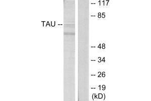 Western blot analysis of extracts from HeLa cells, using Tau (Ab-396) antibody. (MAPT 抗体  (Ser396))