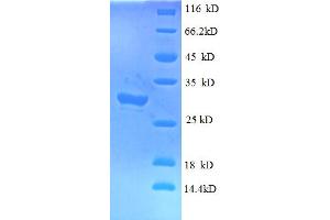 SDS-PAGE (SDS) image for Interferon-Induced Transmembrane Protein 1 (IFITM1) (AA 1-36), (Extracellular) protein (GST tag) (ABIN5712123) (IFITM1 Protein (AA 1-36, Extracellular) (GST tag))
